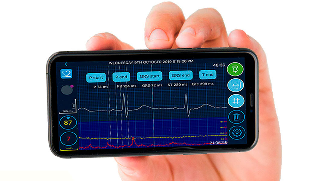 Beat2Phone ECG -mobiilisovellus